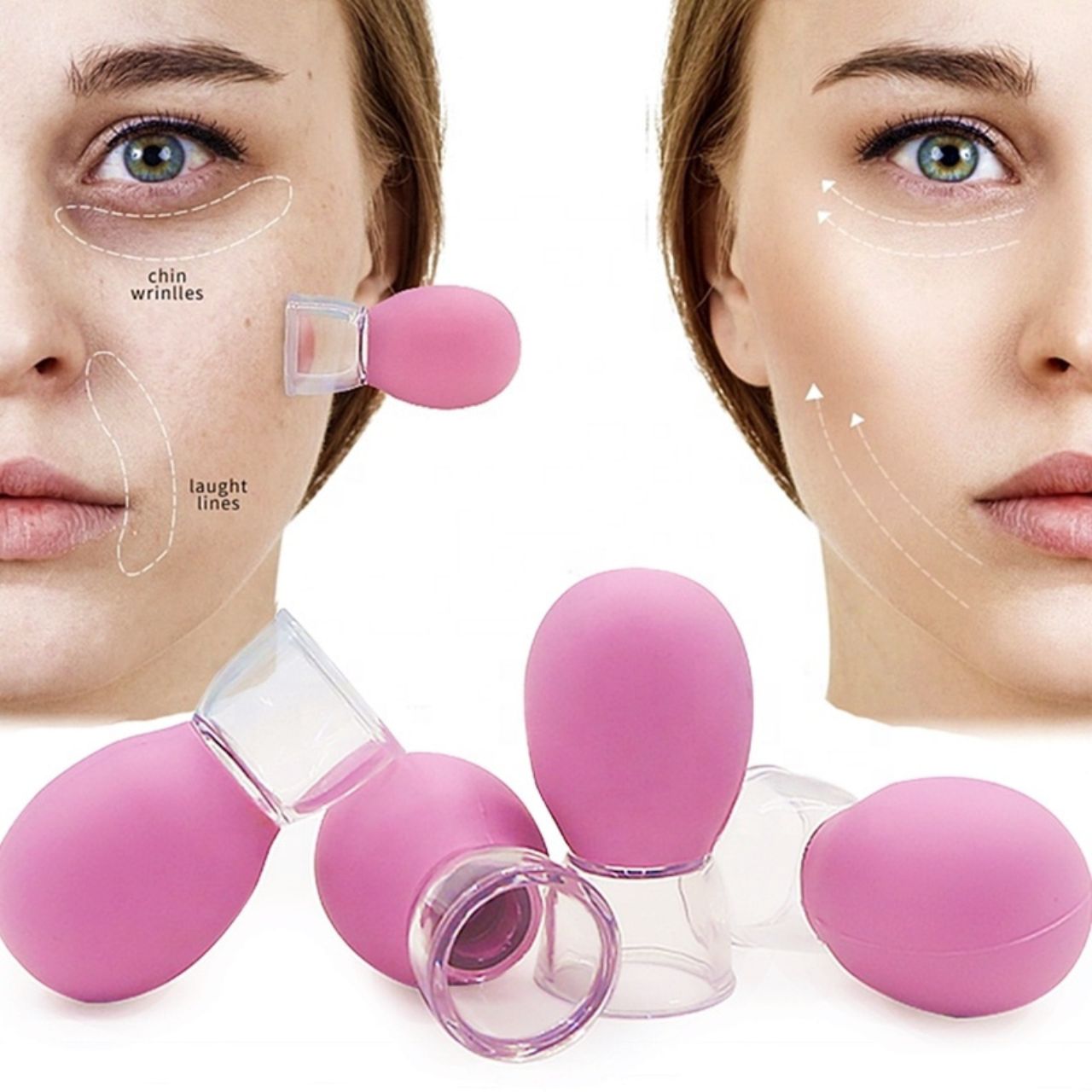 Facial cupping set